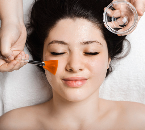 Chemical Peel
